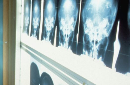 Radiologia