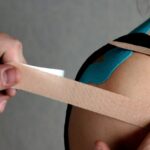 doświadczony fizjoterapeuta wykonuje plastrowanie plastrami do kinesiology tapingu pacjentowi w okolicy obręczy barkowej