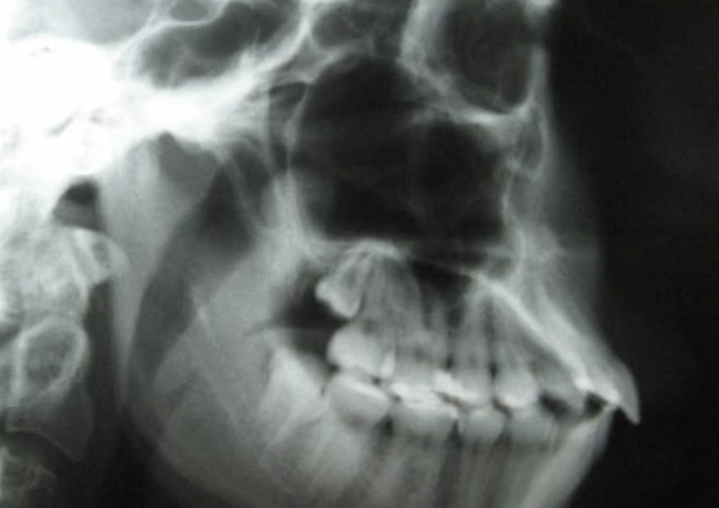 rehabilitacja w stomatologii